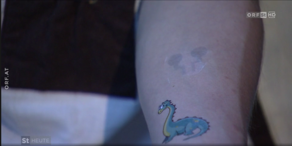Tattoo on skin_ORF